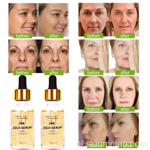 24K Gold Serum Anti Aging Face Collageen Serum